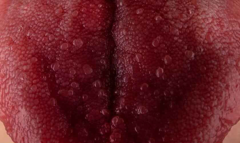 small wart like bumps on tongue