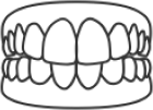 Dental illustration showing upper and lower teeth alignment and bite arrangement.