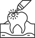 Tooth receiving fluoride treatment from dropper in dental care setting.