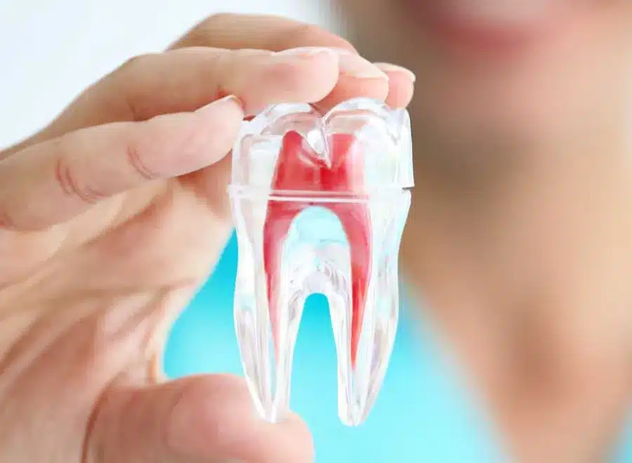 Hand holding dental model showing tooth cross-section anatomy against blue background